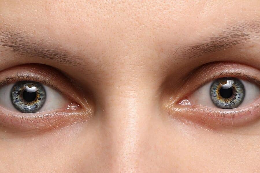 Pinpoint pupils alone do not confirm drug misuse or overdose and must be evaluated alongside other symptoms like slowed breathing and altered consciousness.